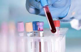 Một mẫu máu xét nghiệm ADN