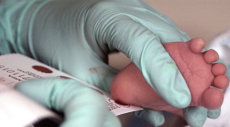 Mục đích của xét nghiệm ADN sau sinh