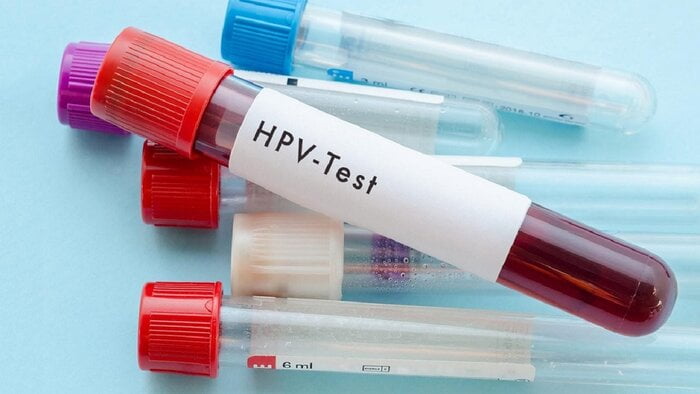 Xét nghiệm HPV trong tầm soát ung thư cổ tử cung