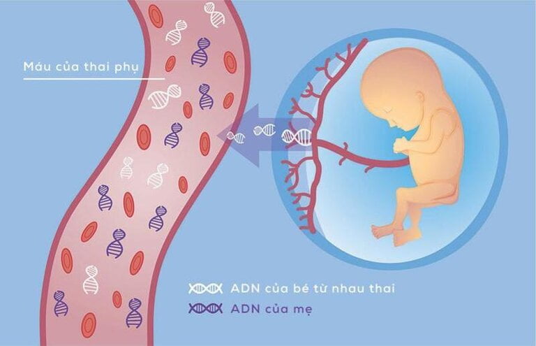 Xét nghiệm ADN thai nhi bằng máu của mẹ