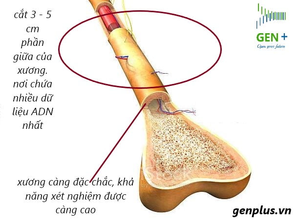 Xét Nghiệm ADN Mẫu Xương Được Không ?