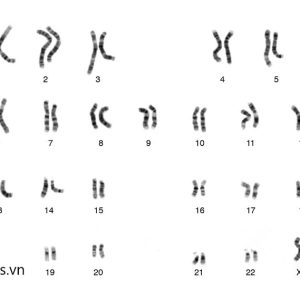 ket-qua-xet-nghiem-karyotype-cua-mot-ban-nam-gioi-genplus-1