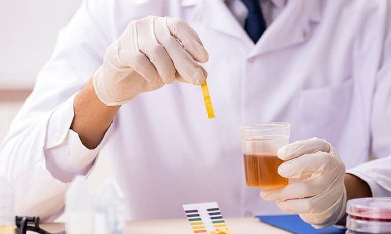 Thu mẫu nước tiểu để tiến hành xét nghiệm ADN cần lưu ý gì?