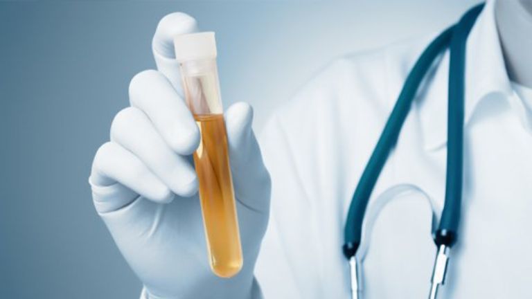 Mẫu nước tiểu có thể bảo quản bao lâu trước khi đưa đi xét nghiệm ADN?