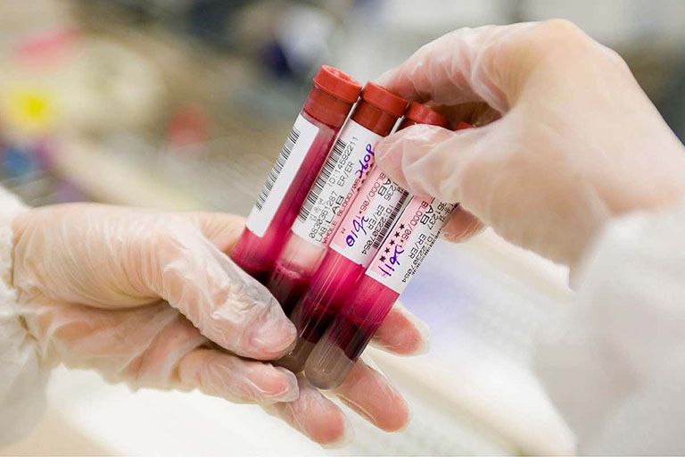 Xét nghiệm ADN sau sinh bằng mẫu máu