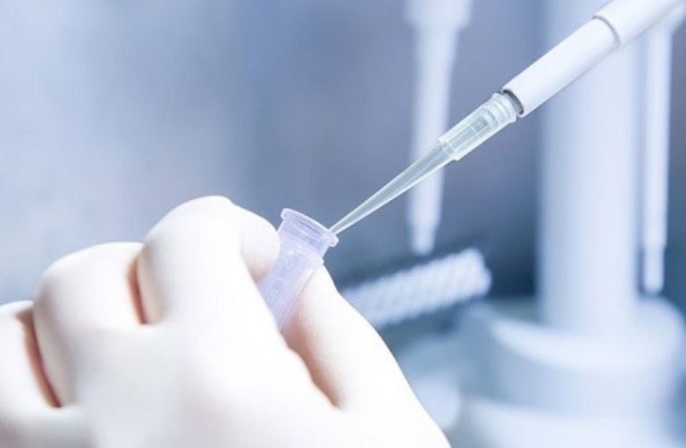 Quy trình xét nghiệm HPV PCR