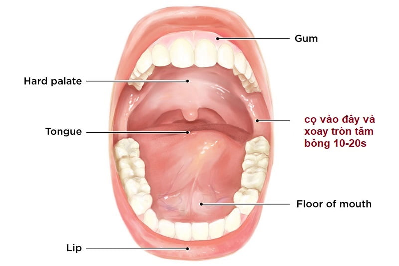 xét nghiệm adn bằng niêm mạc miệng