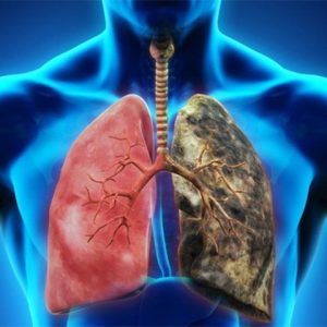 xét nghiệm đột biến gen trong ung thư phổi