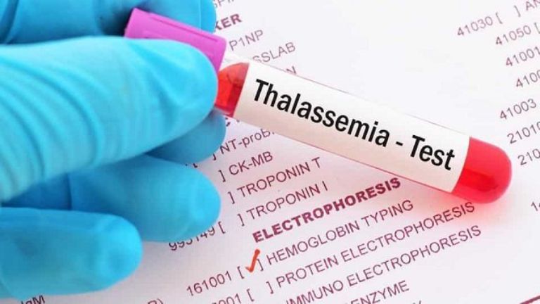 xét nghiệm gen thalassemia cho thai nhi
