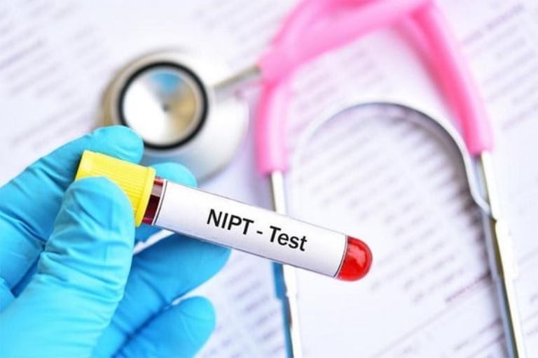 Xét Nghiệm NIPT Là Gì? Giá Bao Nhiêu Tiền? (cập nhật 2026)
