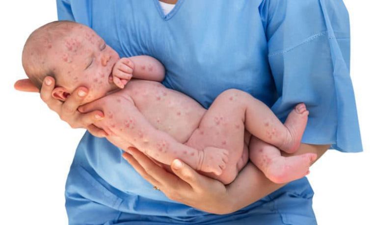 Dị Tật Thai Nhi: Nguồn Gốc, Độ Nguy Hiểm (Tư Vấn A-Z)