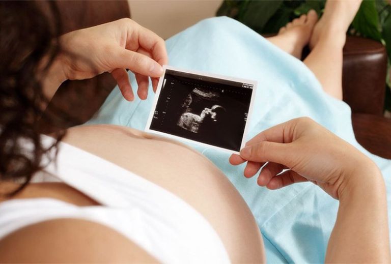 Sàng Lọc Dị Tật Thai Nhi Gồm Những Gì? Tư Vấn A-Z