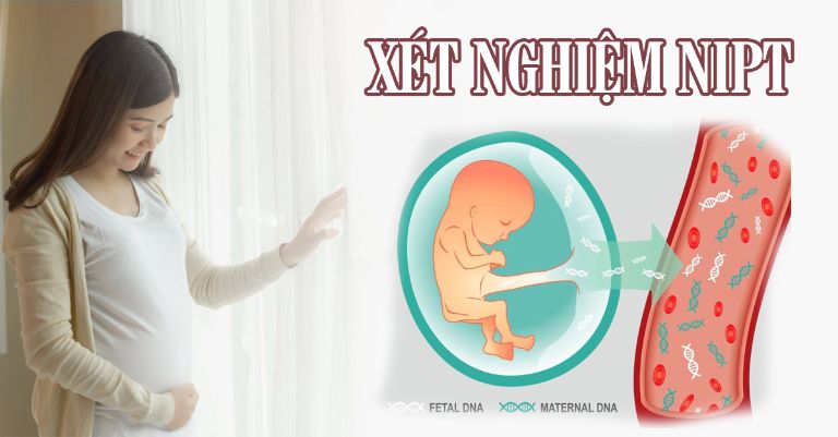 Xét Nghiệm NIPT Có Cần Thiết Không? Mẹ Bầu Nên Làm Không?