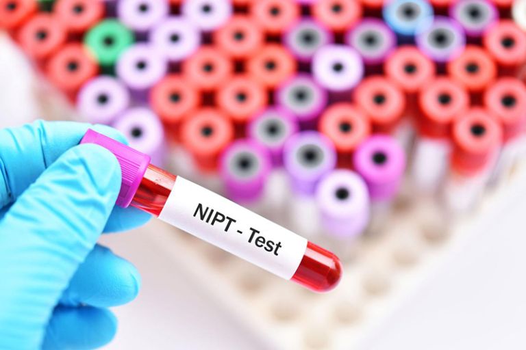 Xét Nghiệm NIPT Phát Hiện Những Bệnh Gì, Hội Chứng Nào?