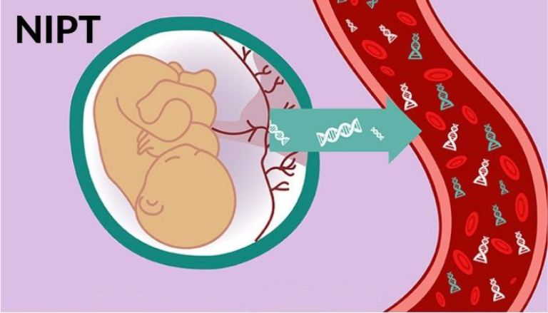 Xét Nghiệm NIPT Phát Hiện Thalassemia Ở Tuần Bao Nhiêu?