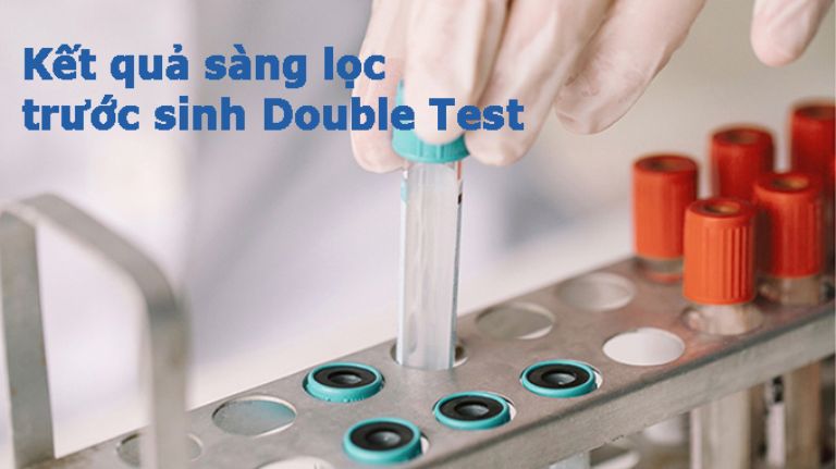 Sàng lọc Double test