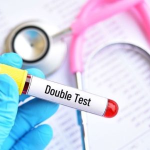 sàng lọc double test