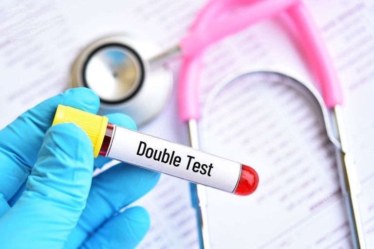 xét nghiệm Double test cho thai đôi