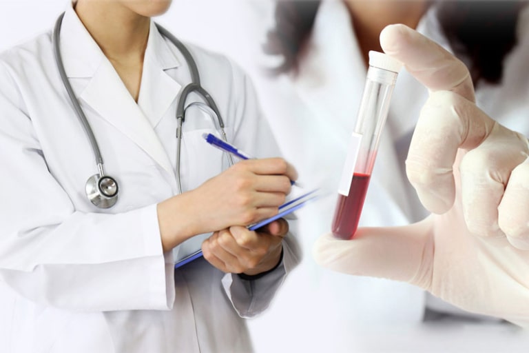 Xét Nghiệm Máu: Chi Phí, Phân Loại, Chỉ Số, Phạm Vi Xét Nghiệm