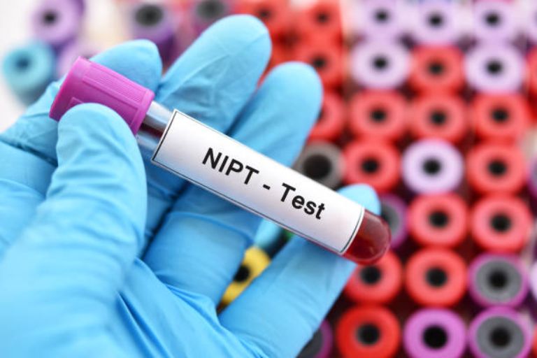 Xét nghiệm NIPT 9 tuần có chính xác không?