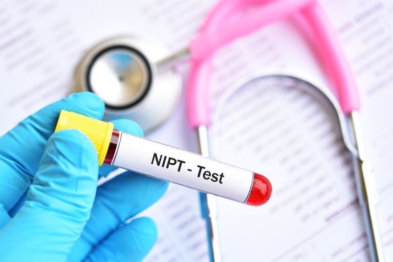 Chi phí xét nghiệm NIPT tại Bắc Giang hiện nay