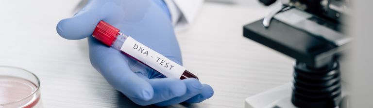 Xét nghiệm ADN Hậu Giang cần chuẩn bị những gì?