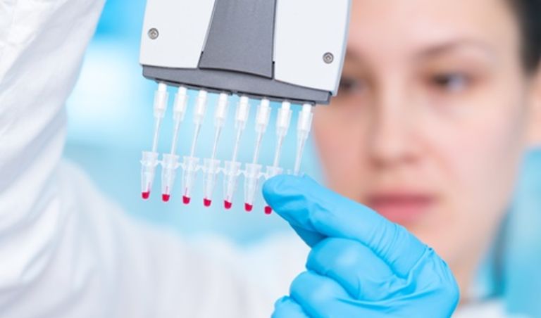 Top 4 đơn vị xét nghiệm gen chuyên nghiệp ở Lai Châu