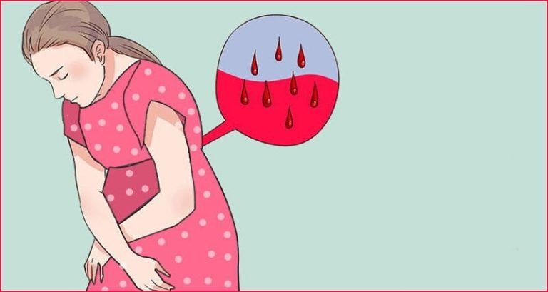 thrombophilia dễ xảy ra với phụ nữ mang thai